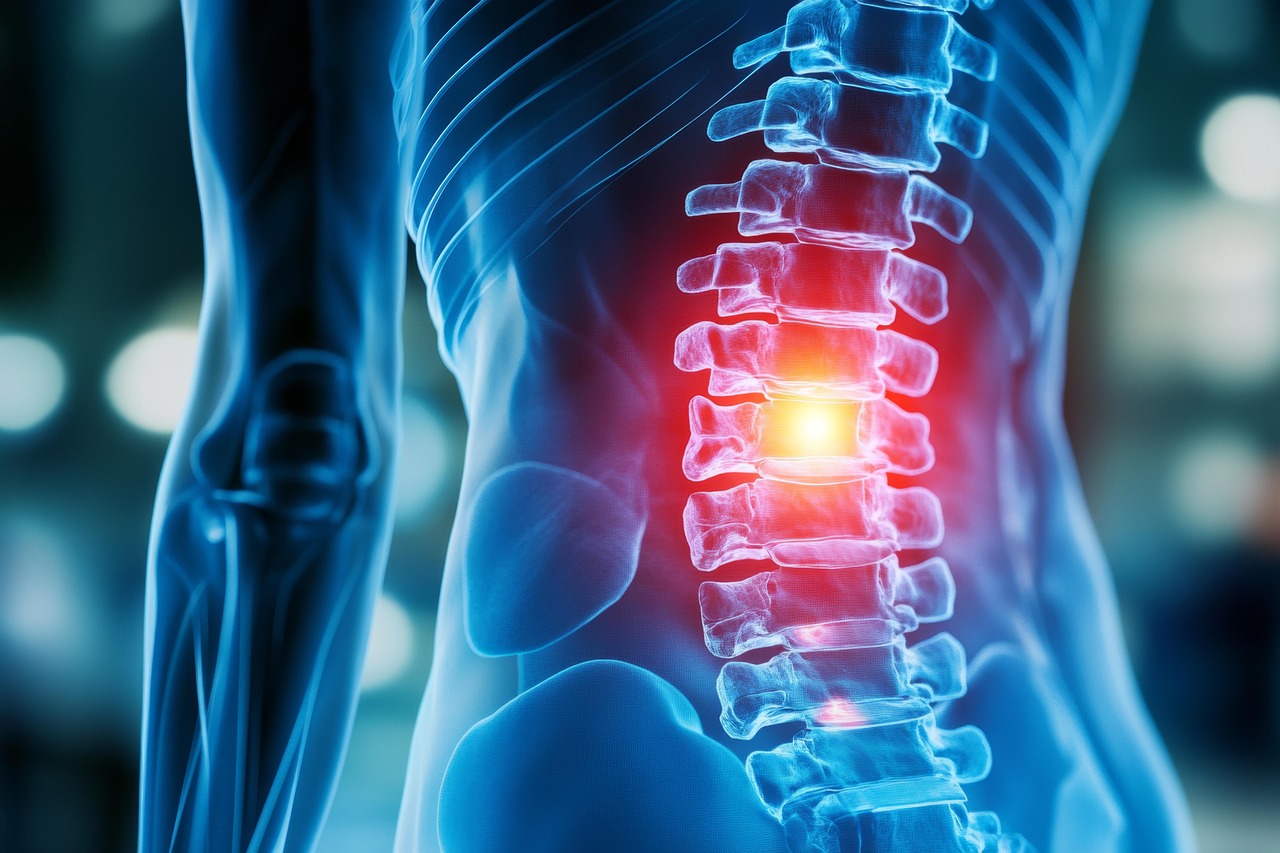 bandscheibenvorfall-r-ckenschmerzen-arthrose-karosserie-x-ray-anatomie-schmerz-medizinisch-wirbels-ule-die-gesundheit-verletzung-gelenke-skelett-scan-arthritis-zur-ck-knochen.jpg