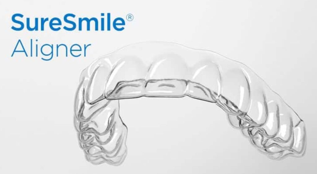 suresmile-clear-aligners-1024x564.jpg