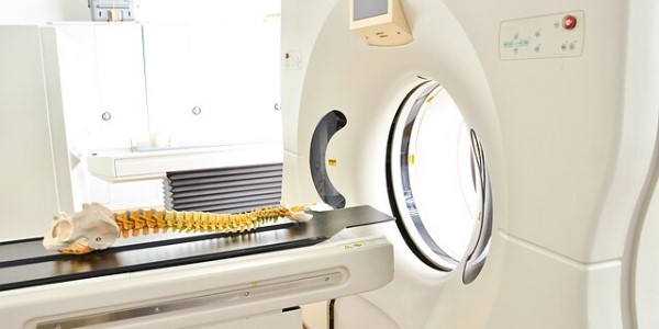 Computertomografie um Frontotemporale Demenz festzustellen Computertomografie