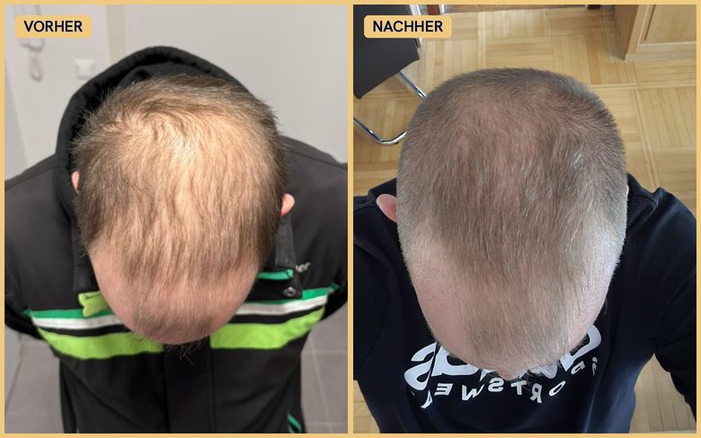 Vorher Nachher Jürgen