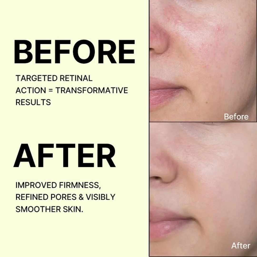 06_Before_after.jpg.webp