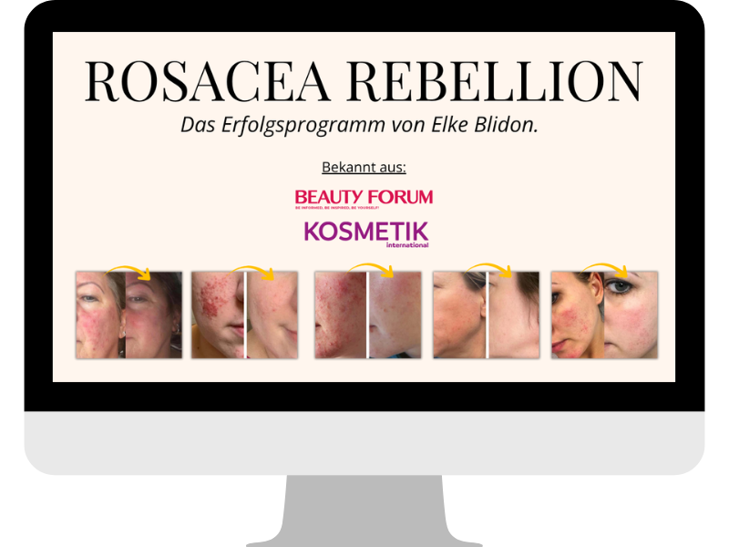 Elke Rosacae Rebellion Mock-up.png