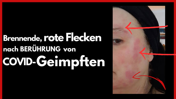 Shedding ist Fakt - Was kannst du tun?