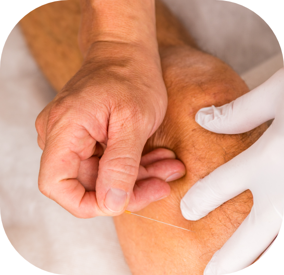 lim-Dry needling.png