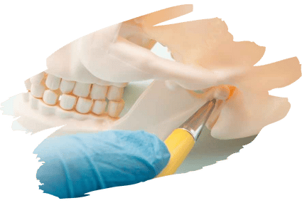 Craniomandibuläre Dysfunktion (CMD)