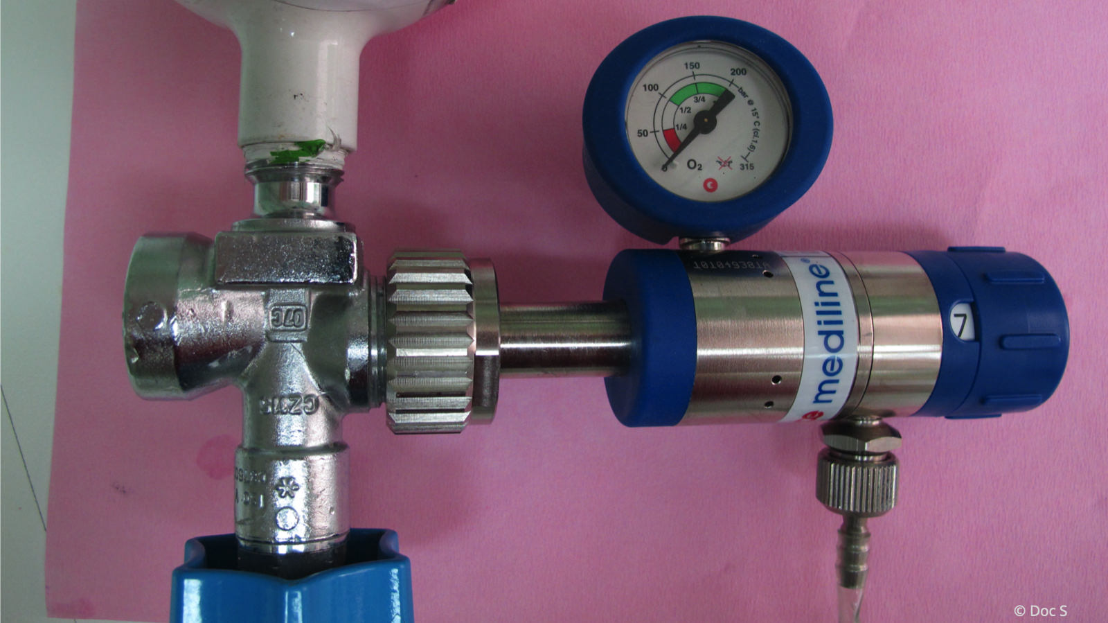 Sauerstoffzufuhr während der Amalgamentfernung, um zu verhindern, dass Quecksilberdampf eingeatmet wird.