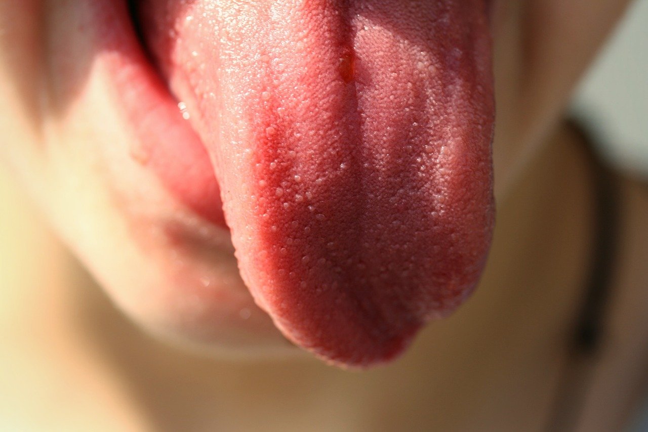 Pickel auf der Zunge