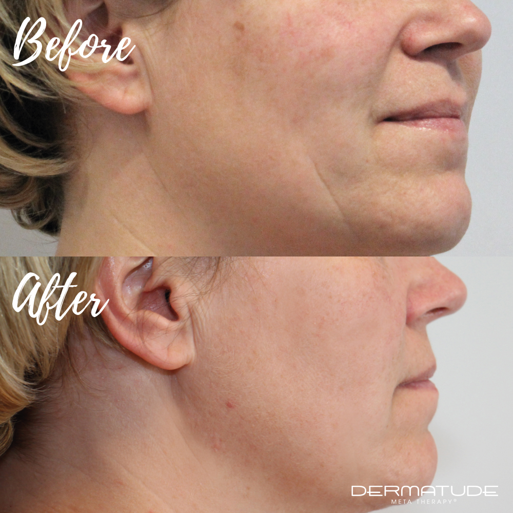 Before & After 12.jpg