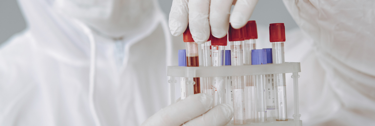 Forscher im Labor untersucht Blut im Reagenzglas zur Blutgrupperndiät