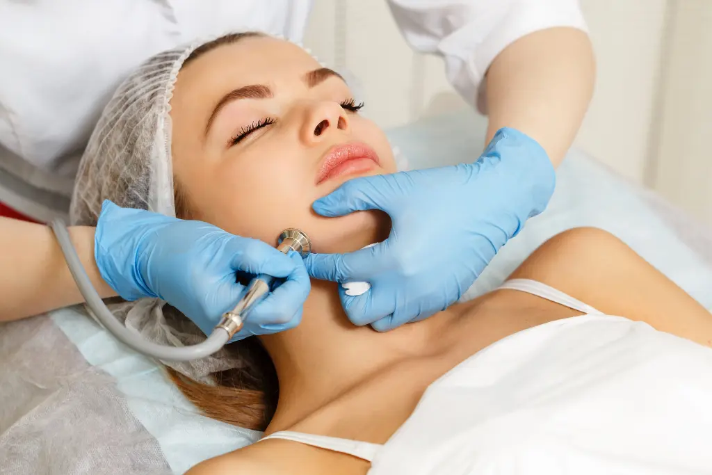 Dermabrasion_.webp