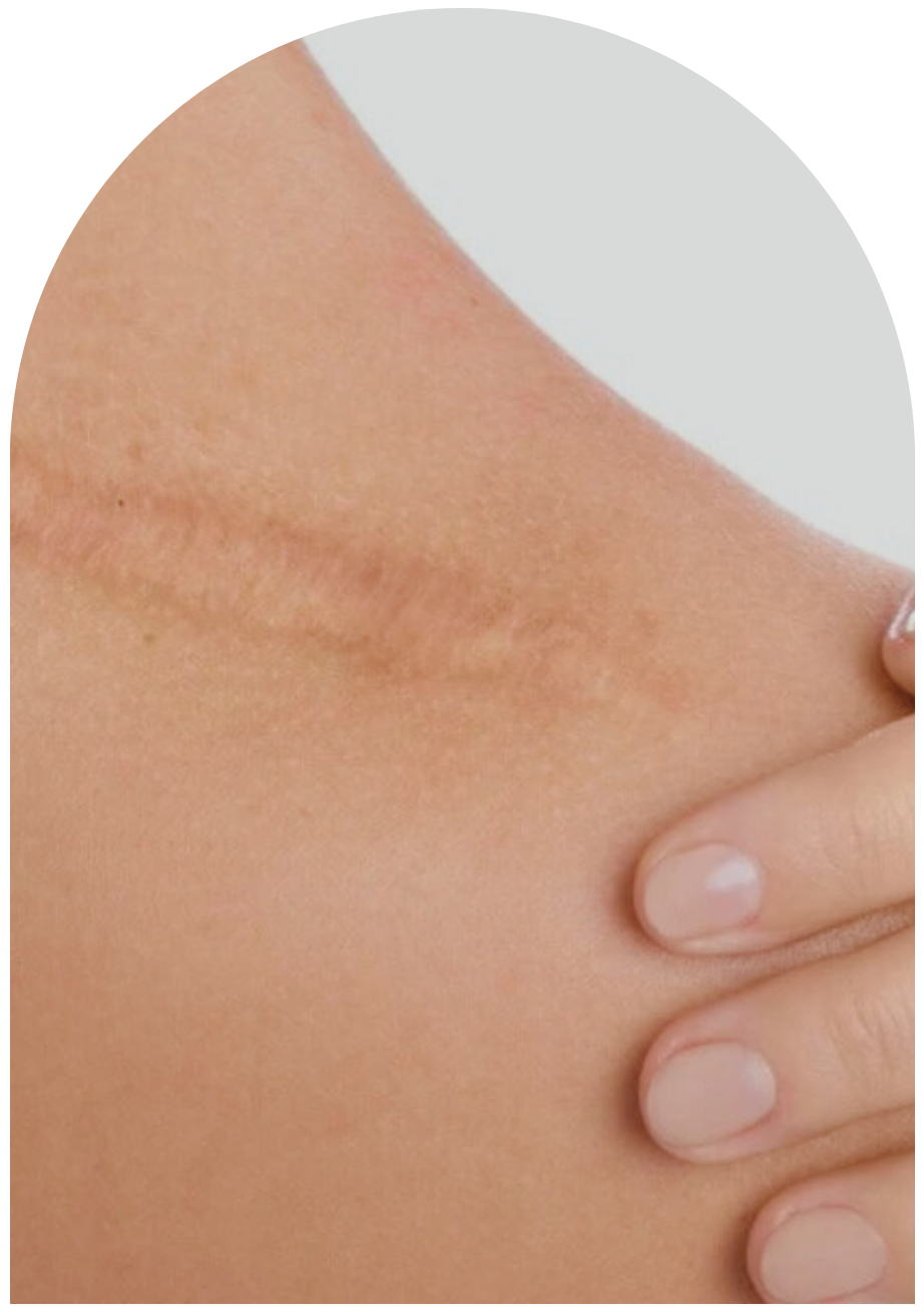 Neuraltherapie Ulm.png