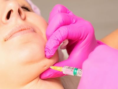 Doppelkinn 400 300 .jpg