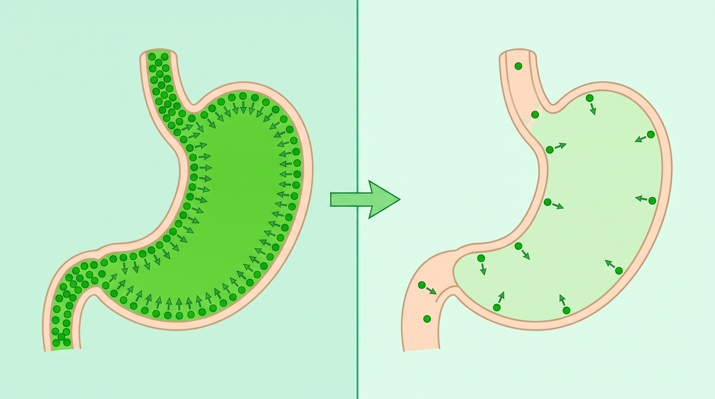 Grafik: links ein Magen kurz nach dem Absetzen mit sehr vielen kleinen Säurepumpen in der Magenwand und kräftig grün gefülltem Innenraum, rechts derselbe Magen nach Monaten mit nur noch wenigen Pumpen und blass gefülltem Innenraum, dazwischen ein Pfeil für den langsamen Rückbau